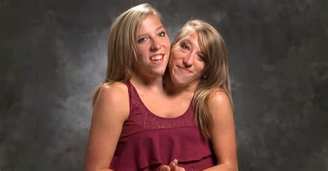 conjoined twins abby and brittany photos|did the hensel twins died.